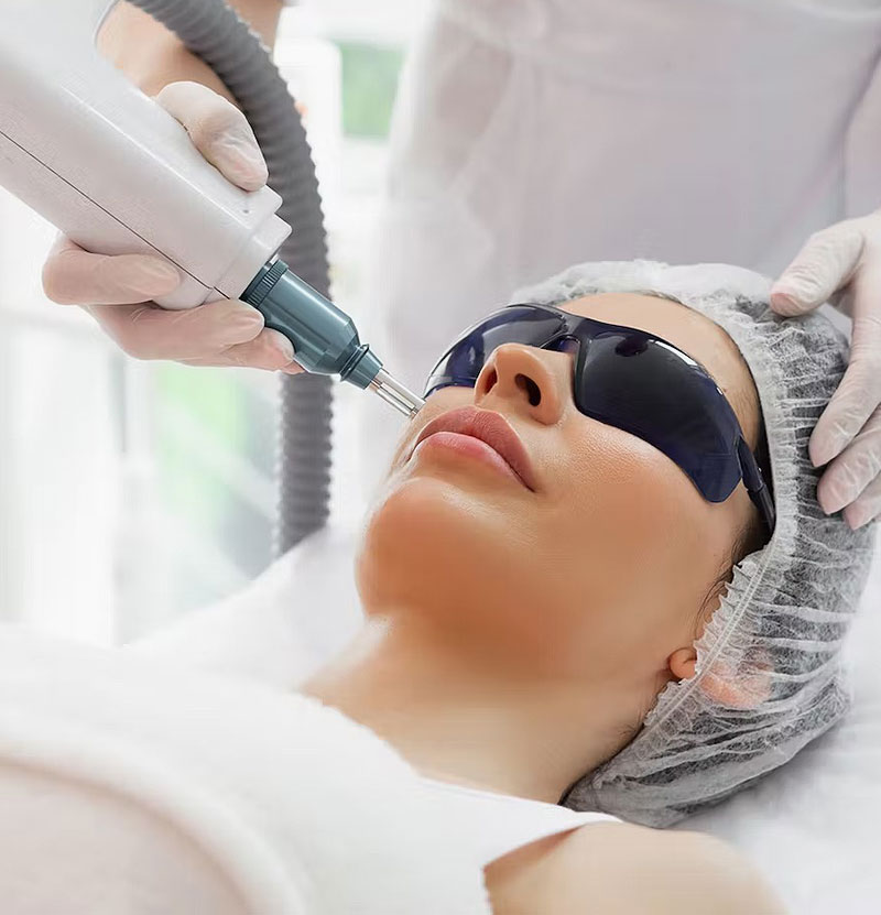 stock image of model with facial therapy treatment