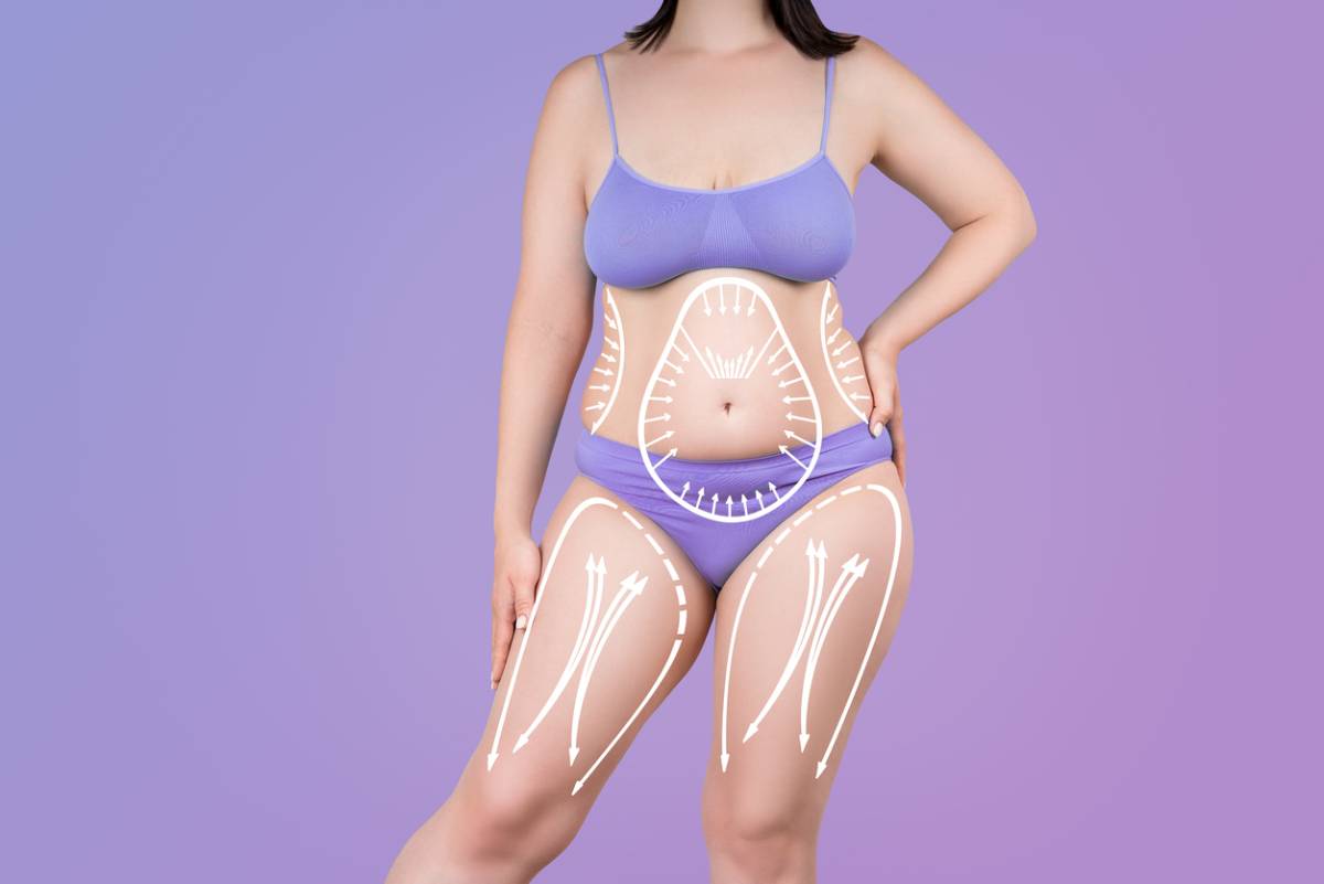 features that combine procedures with tummy tuck